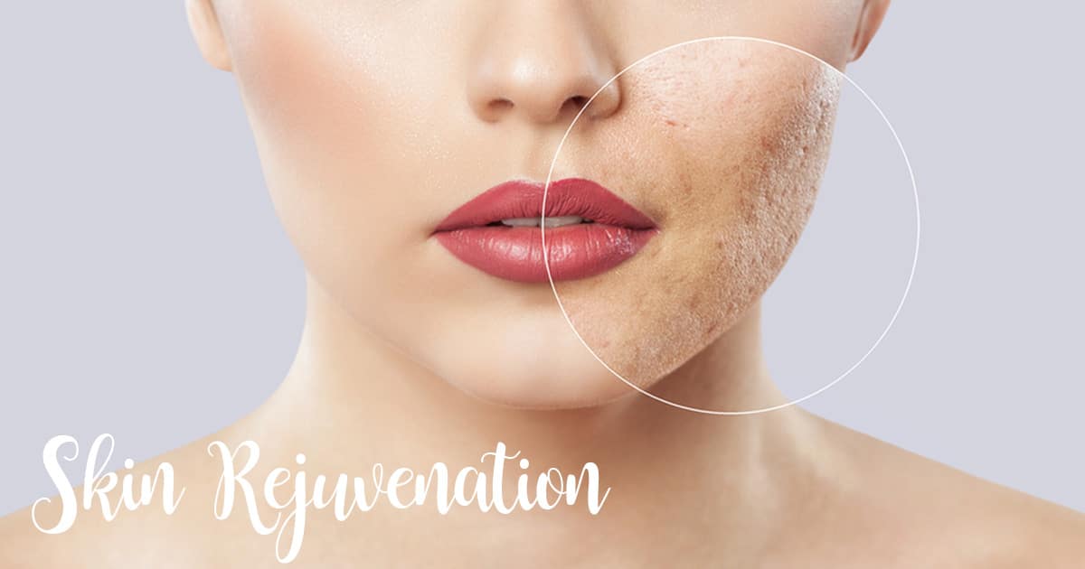Laser Skin Rejuvenation Chicago