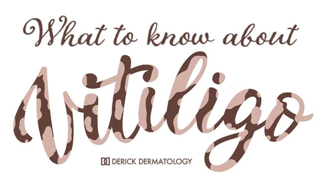 What to Know About Vitiligo